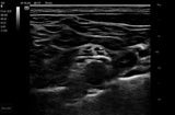 Mindray TE7 Max T Ultrasound