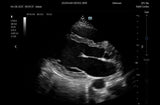 Mindray TE7 Max Point of Care Ultrasound
