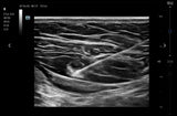 Mindray TE7 Max T Ultrasound