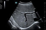 Mindray TE7 Ultrasound System Crystal Series 2.0