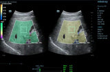 Mindray Resona 7 Platinum Edition Ultrasound System