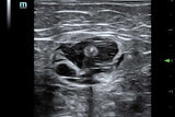 Mindray TE5 Ultrasound System
