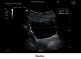 Mindray TE7 Max Point of Care Ultrasound
