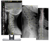 20/20 CFPH Hybrid 17x17 Chiropractic Direct Digital Imaging System - DR Panel