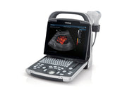 Mindray DP-30 Power Ultrasound Imaging System (72-Month Subscription)