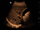 Mindray DP-50 Expert Mobile Ultrasound System (72-Month Subscription)