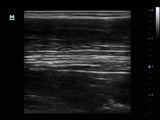 Mindray DP-30 Power Ultrasound Imaging System (72-Month Subscription)