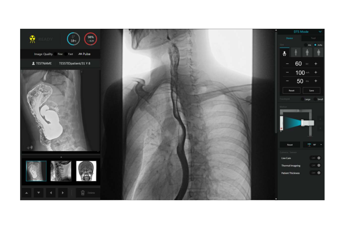 StriXion™ Smart Digital Multi-Modality System