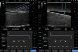Mindray TE5 Ultrasound System