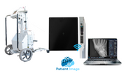 Mobile 1 - Digital X-ray System (72-Month Subscription)