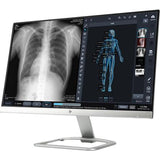 Digital X-ray Panel - 17 x 17 Tethered (72-Month Subscription)
